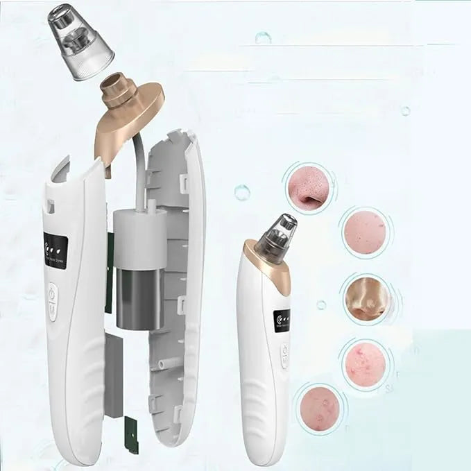 5-in-1 Rechargeable Blackhead Remover – Vacuum Suction Pore Cleaner & Acne Extractor